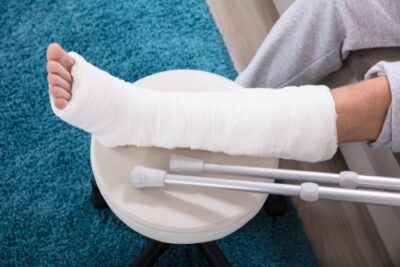 Savannah ga broken bones lawyer