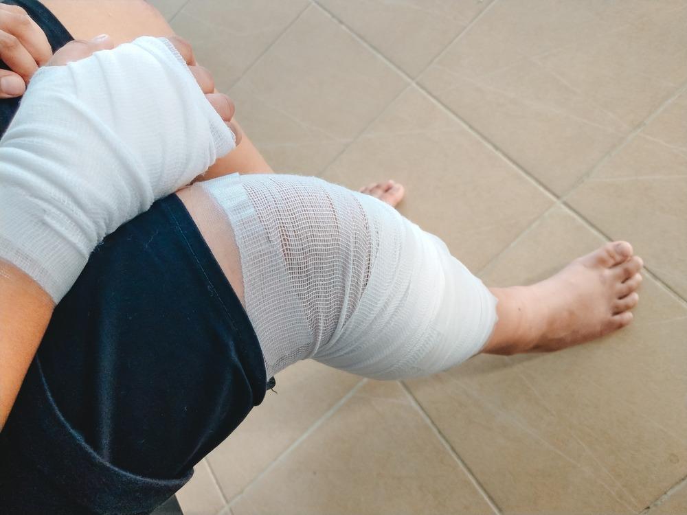 injured man with bandaged hand and knee