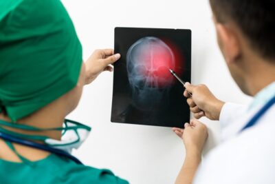 Nurse and doctor looking at x ray of head