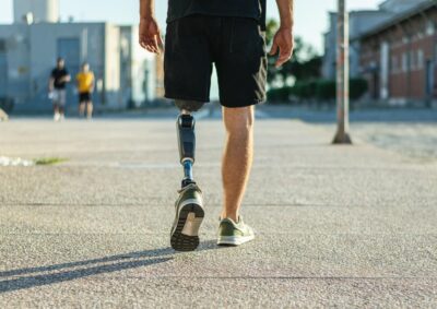 Man walking with a prosthetic leg