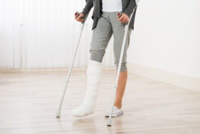 Woman in full leg cast