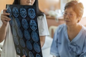 Woman reviewing brain scan with a patient