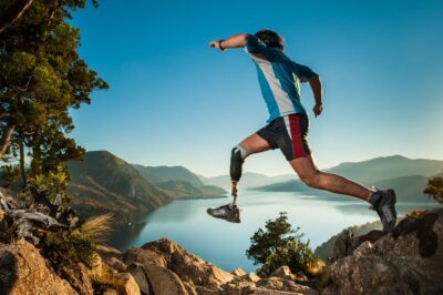 Man with a prosthetic leg