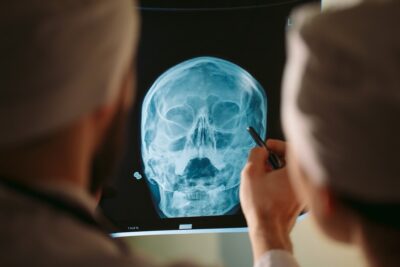 Doctor going over head x ray with a patient