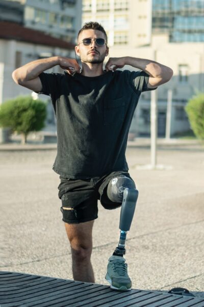 Man with prosthetic leg