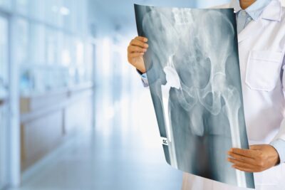 Biomet hip replacement lawsuit lawyer