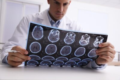 Doctor evaluating mri images of a concussion